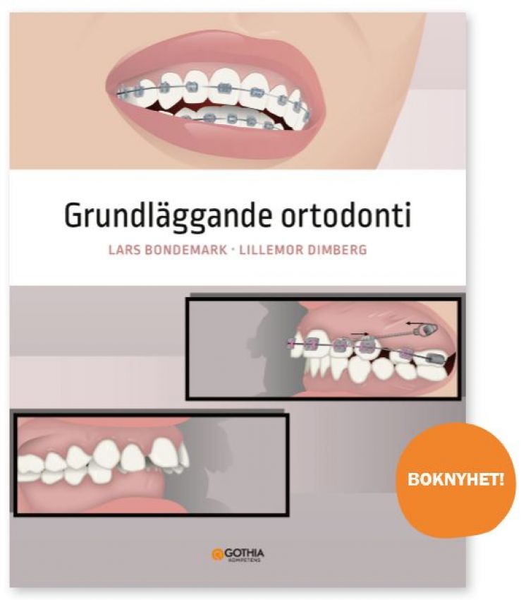 Grundläggande ortodonti